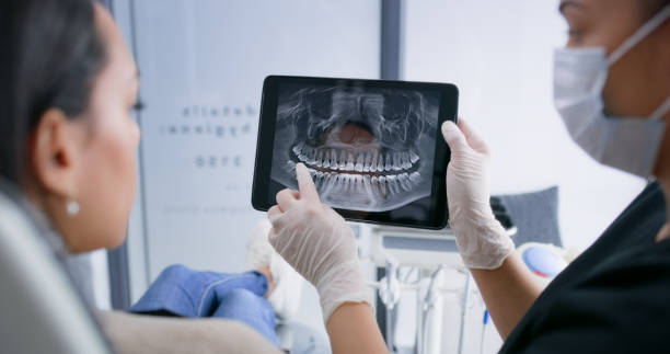Licensed Wisdom Tooth Removal service in Bude, MS - Smile Center Dentistry